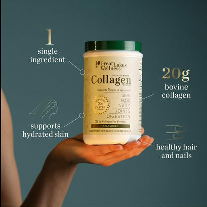 Collagen Peptides Powder – Supports Skin, Hair, Nails, Joints & Digestion – Hydrolyzed, Quick Dissolve, Non-Gmo, Keto & Kosher – Pure Collagen Protein (10 Oz, 14 Servings)